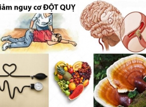 Giảm nguy cơ, phòng ngừa đột quỵ ngay tại nhà